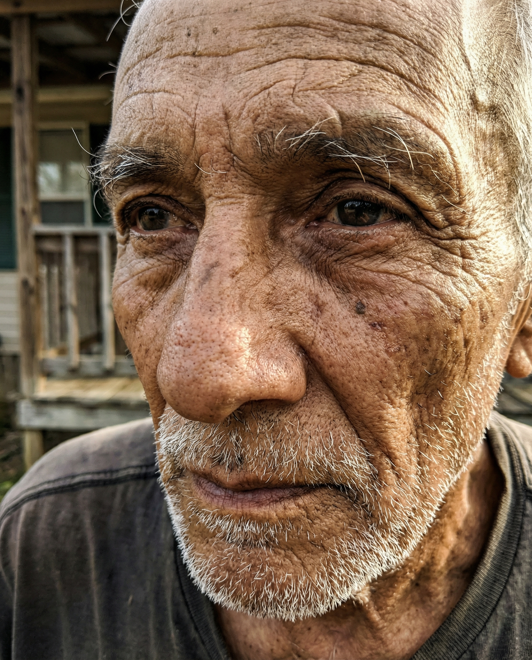 O fim da pele de boneca 📸